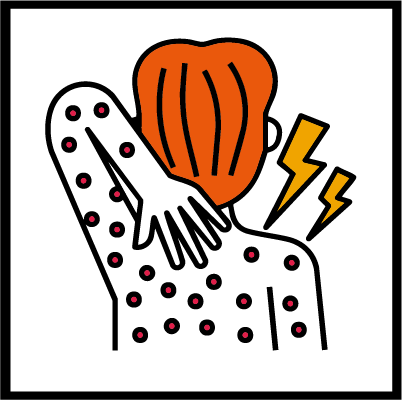 Nappy Rash
